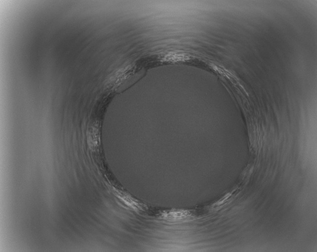 X0000052980517200507151831