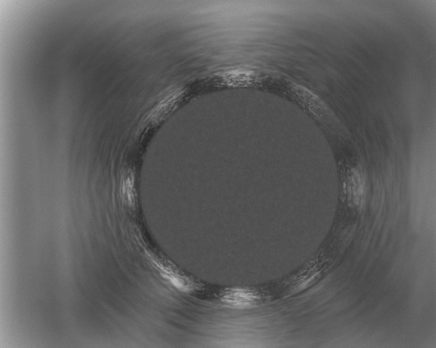 X0000052980610200507151830