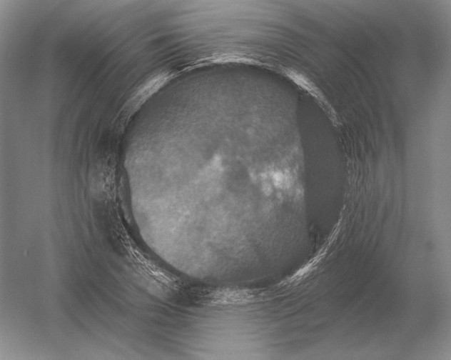 X0000052980977200508051036