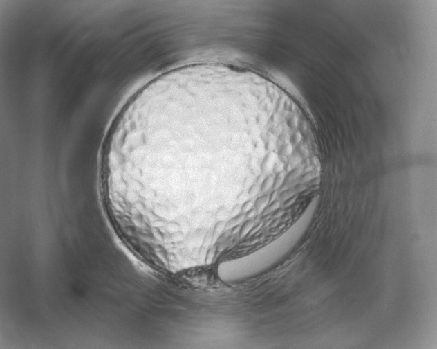 X0000052981103200508051034