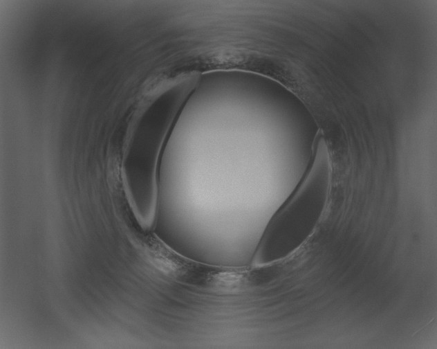 X0000053000176200507081005