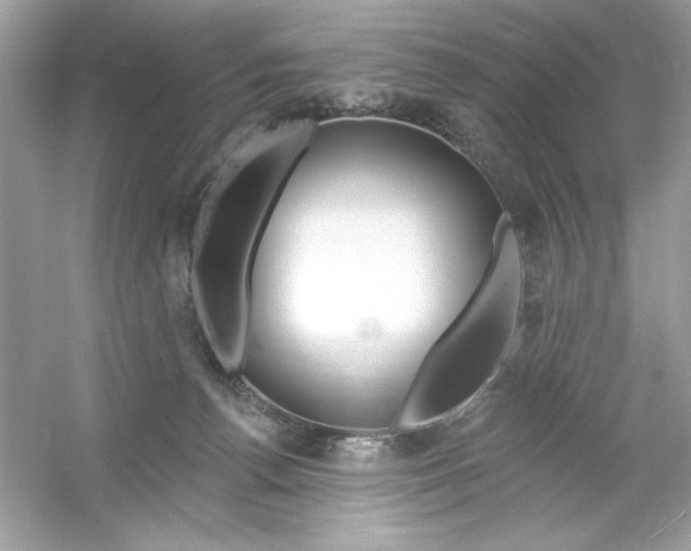 X0000053000176200508051143