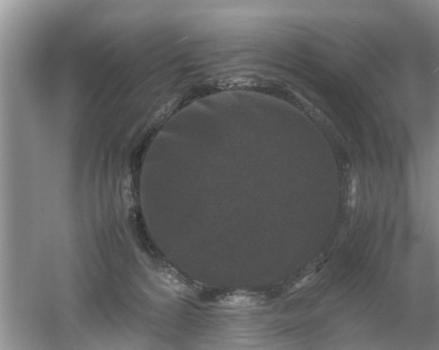 X0000053010224200507151956