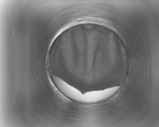 X0000053011522200508051147