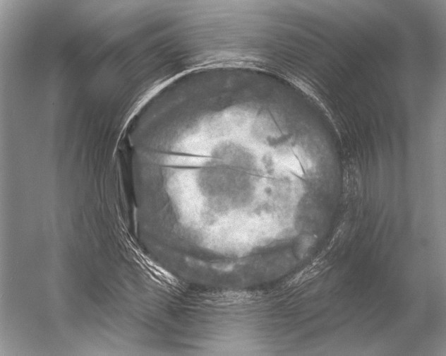 X0000053120925200508081248