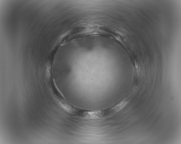 X0000053140188200507251825