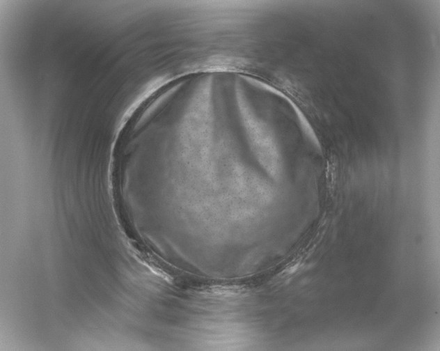 X0000053140292200507251823