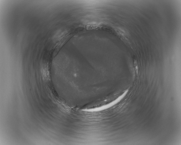 X0000053141252200507251806
