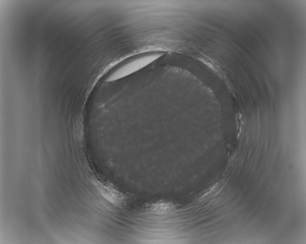 X0000053140204200508081353