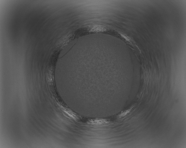 X0000054380517200508011257