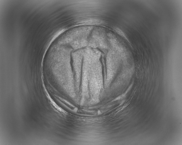 X0000054381087200508270001