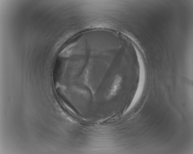 X0000054390577200508270036
