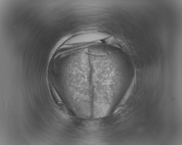 X0000054400147200508192014