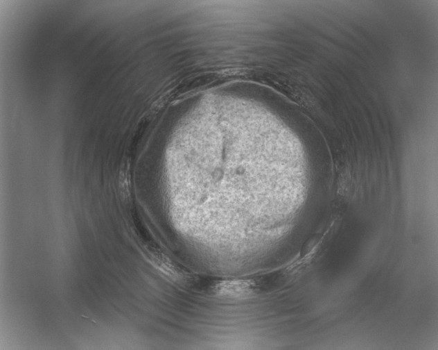 X0000054400179200508192014