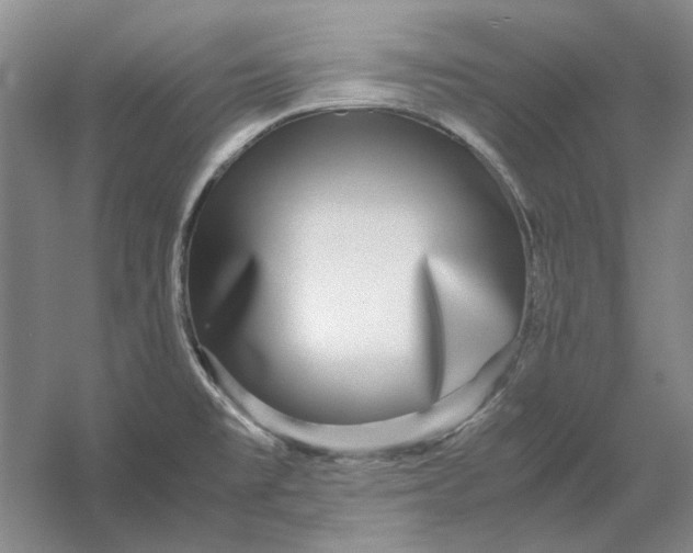 X0000054411477200508192018