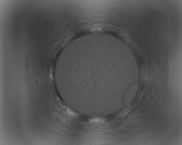 X0000054460561200508011504