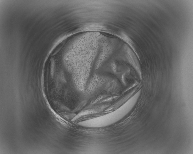 X0000055971147200509091437