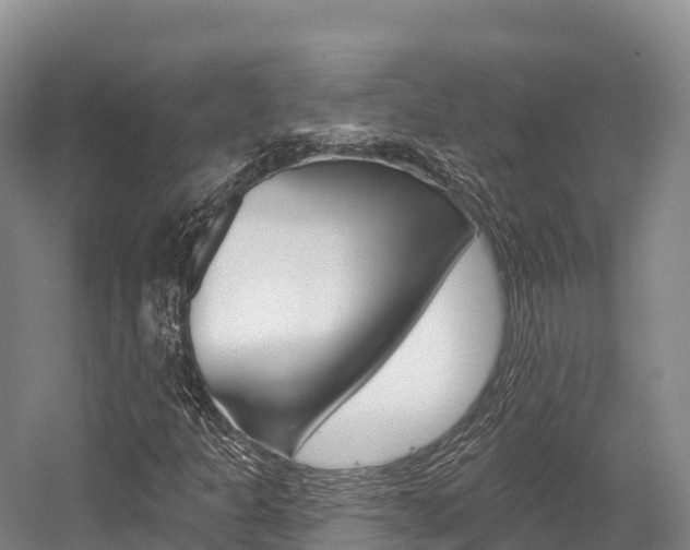 X0000055991301200508190745