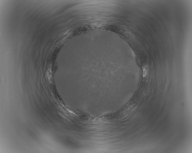 X0000055991011200509092014