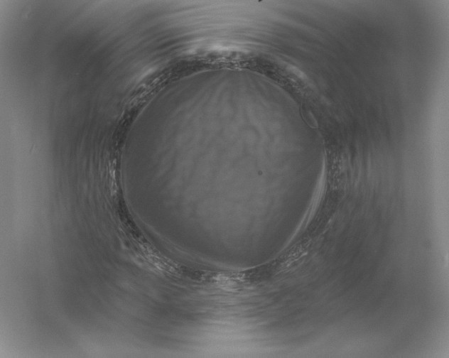 X0000055991013200509092014