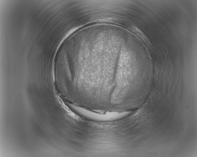 X0000055991036200509092014