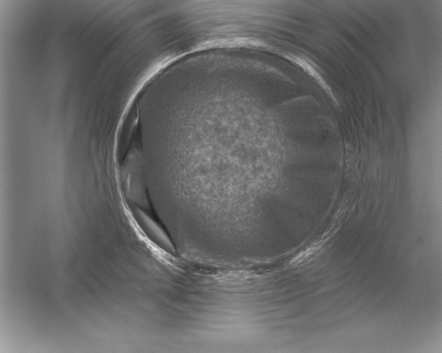 X0000055991046200509092014