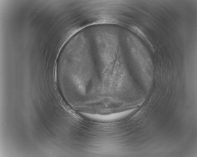 X0000055991276200509092010