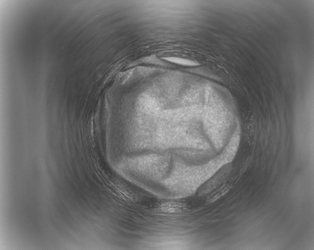 X0000055990708200509162252