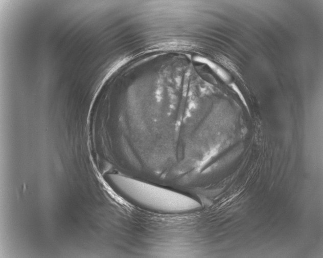 X0000055991087200509162245