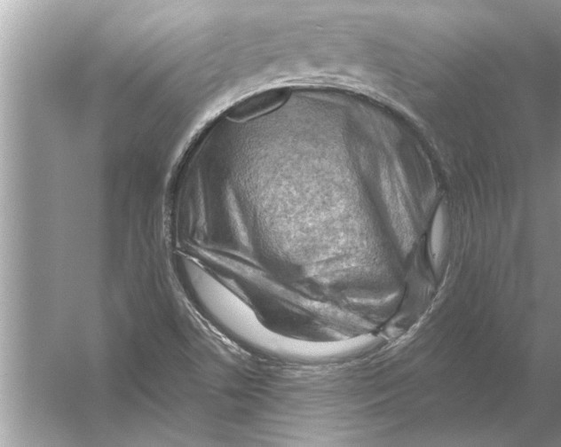 X0000056011506200509162330