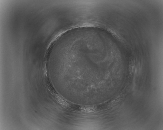 X0000056361262200509021739