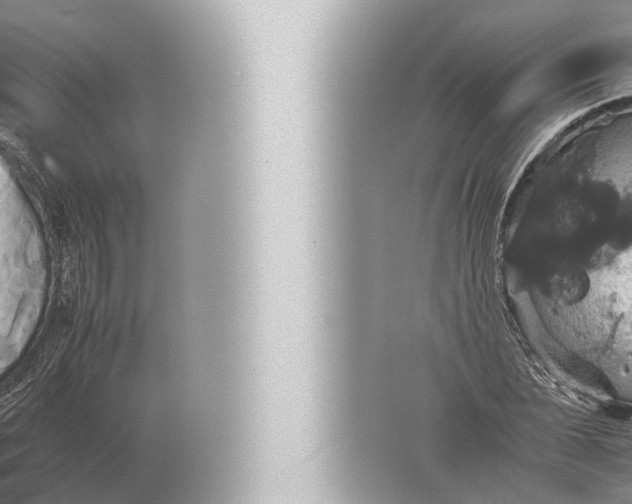 X0000057040878200510010011