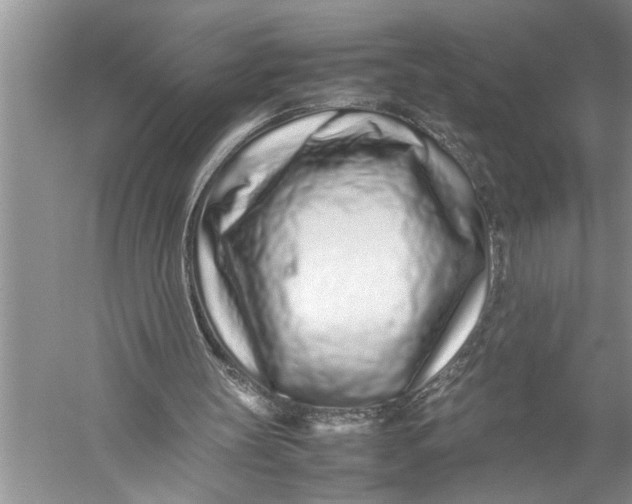 X0000057060147200510010116