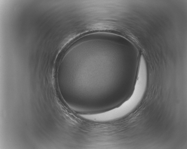 X0000057060387200510010113