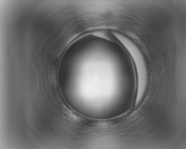 X0000057061177200510010059