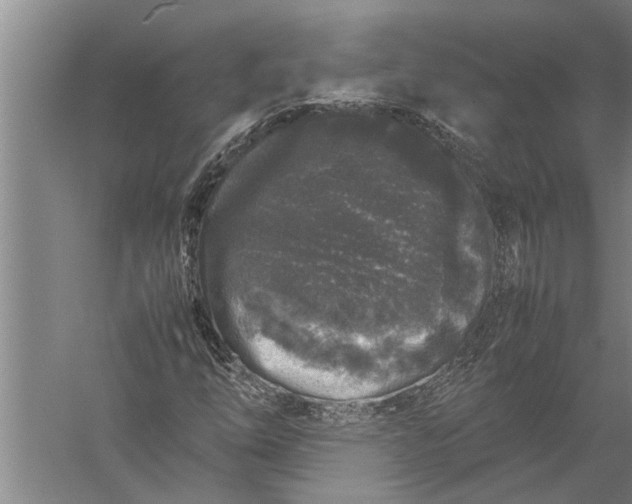 X0000057061254200510010058