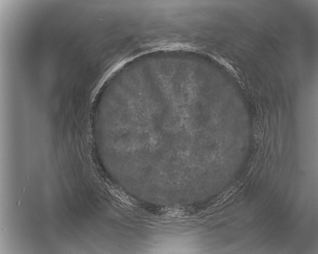 X0000057061263200510010058