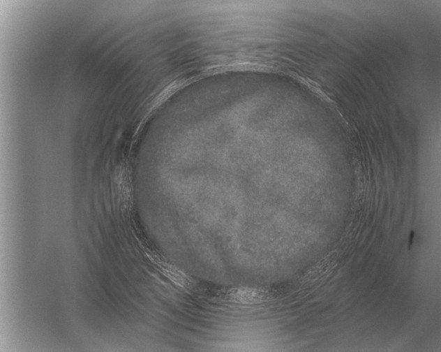 X0000057061266200510010058