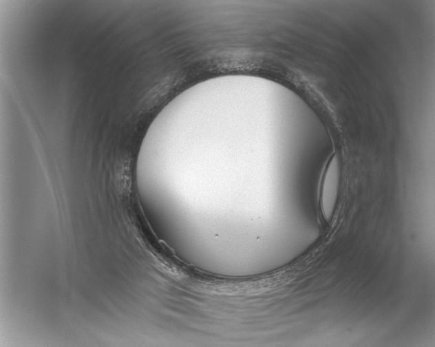 X0000057070017200510010145