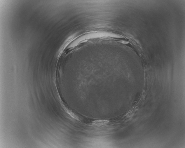 X0000057070051200510010144