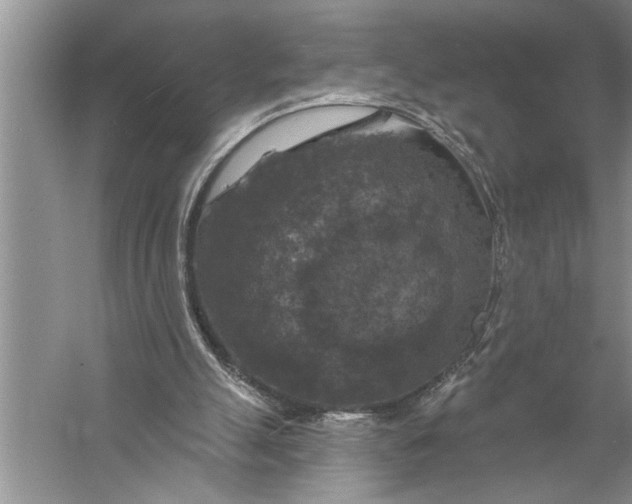 X0000057070055200510010144