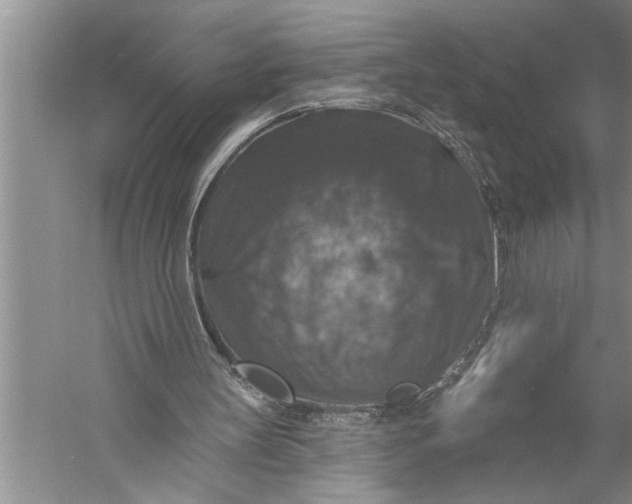 X0000057070147200510010142