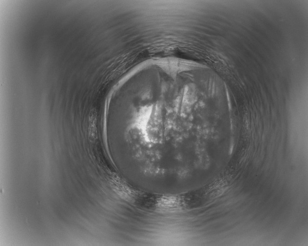 X0000057070177200510010143