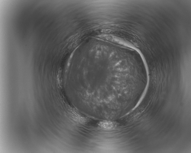 X0000057070181200510010143