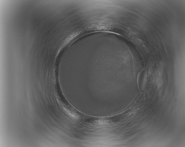 X0000057070250200510010141