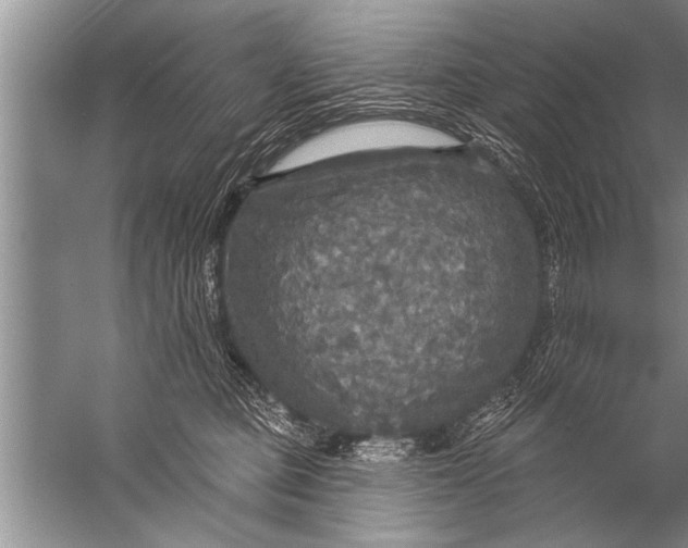 X0000057070373200510010140