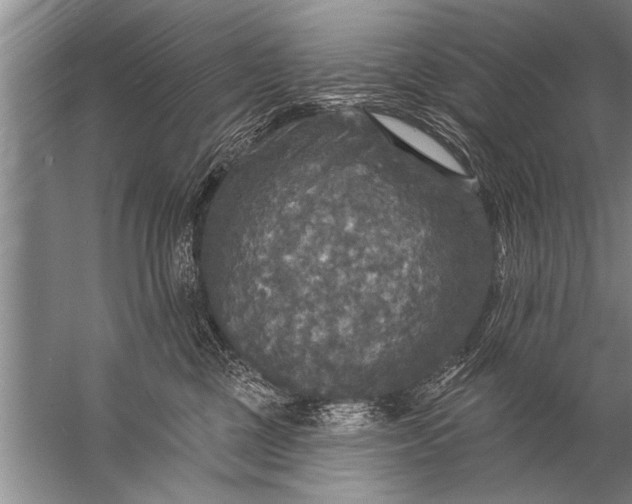 X0000057070377200510010140