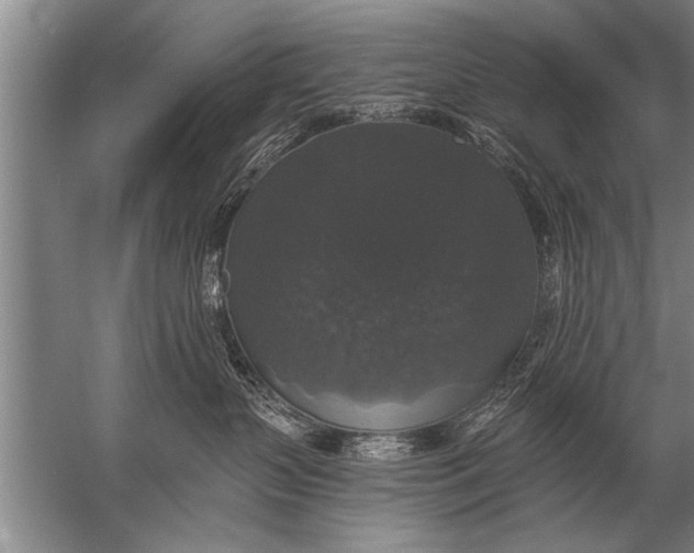 X0000057070383200510010140