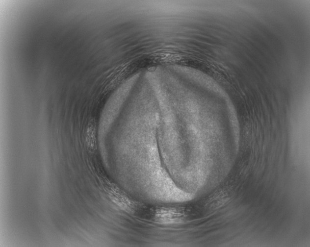 X0000057080177200510010209