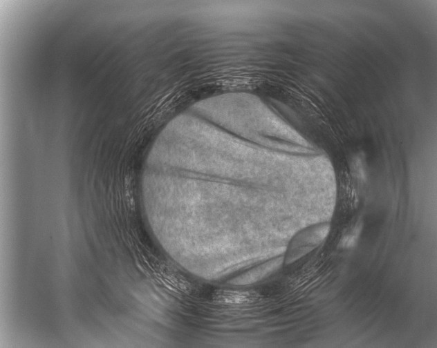 X0000057080663200510010201